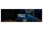 Bring back your true smile with our treatment of root canal in Tijuana