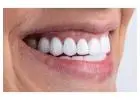 Best Braces Treatment In Gurgaon