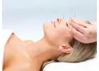 Acupuncture Treatment in Toronto: Holistic Therapy Aimed At Pain Relief And Renewal