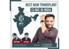 top hair transplant clinics Rajasthan