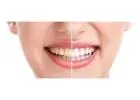 Professional Teeth Whitening Philly Services Helping Patients Achieve Brighter Confident Smiles