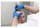Trusted Solutions for Hair Implants in Manchester by Dr Ditta Hair Transplants