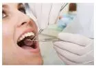Root Canal Treatment in Mount Roskill