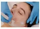 Youthful Glow with Chemical Peel