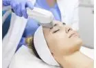 IPL (Intense Pulsed Light) - Mid Florida Dermatology & Plastic Surgery