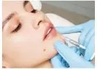 Get Best Lip Filler in Nashville, TN at Amálie Aesthetics