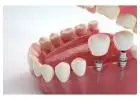 Dental Implants in Northeast Philadelphia for Long Lasting Natural Looking Smiles